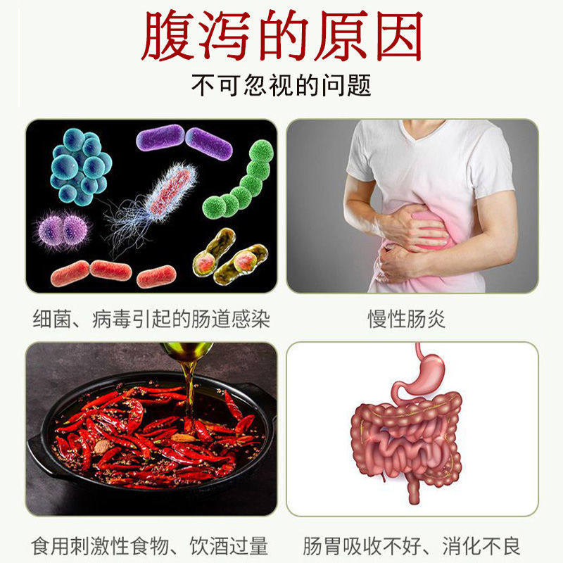 大便不成形膏贴成人儿童反复拉稀贴 飞纯度膏药贴（器械）