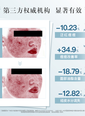 油痘肌ke星！现货澳洲Aspect 热带雨林精华 30ml舒缓控油收缩毛孔