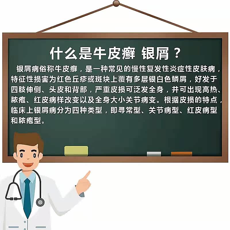 日本牛皮癣皮肤瘙痒手足癣膏药贴 顾仪理疗仪（器械）