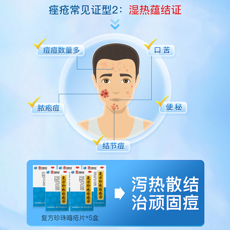 中国药材德众复方珍珠暗疮片中药84片祛痘痘内调痤疮粉刺清热解毒 - 图1