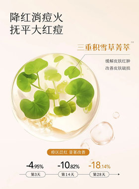 半亩花田山茶花洁面乳氨基酸洗面奶控油祛痘清洁舒缓保湿慕斯泡沫