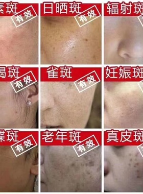 绿本净化妆品光感焕颜净肤组合