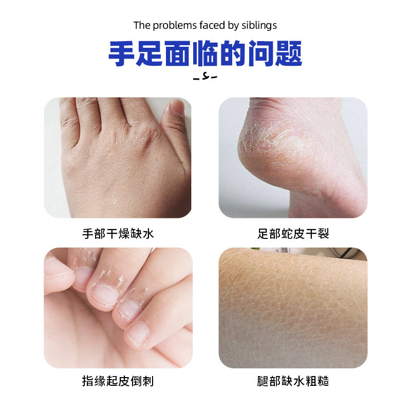 日本叮叮皴裂膏脚后跟滋润秋冬手足防干裂龟裂修复足底手脚皲裂膏,淘宝优惠券,粉丝福利购,淘宝优惠卷