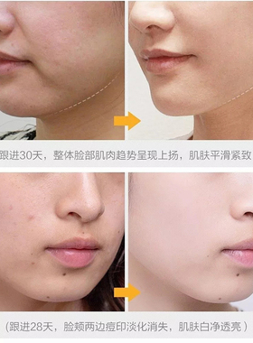 紧致提拉修护淡化鱼尾纹精华液