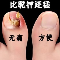 Tongrentang exploits 100 thousand not covered (drop of a drop) painless removal of hands toe bad potassium grey potassium kerb