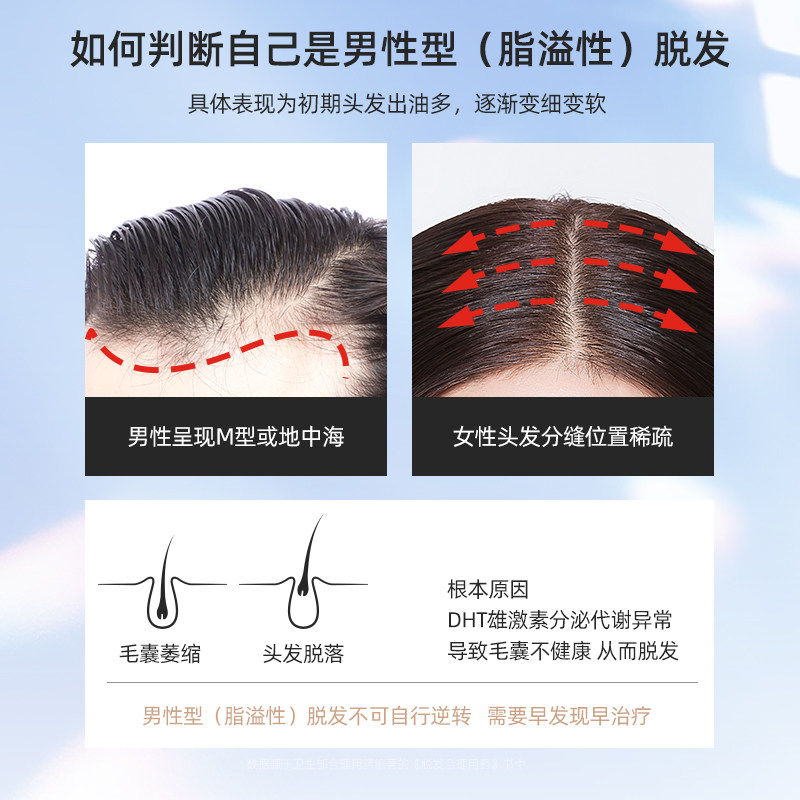 蔓迪90ml曼迪男女性米诺地尔酊溶液 熊猫健康大药房白发脱发