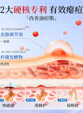水初语多效修护祛痘膏快速瘪痘淡化痘印舒缓红痘痘通用修护痘肌