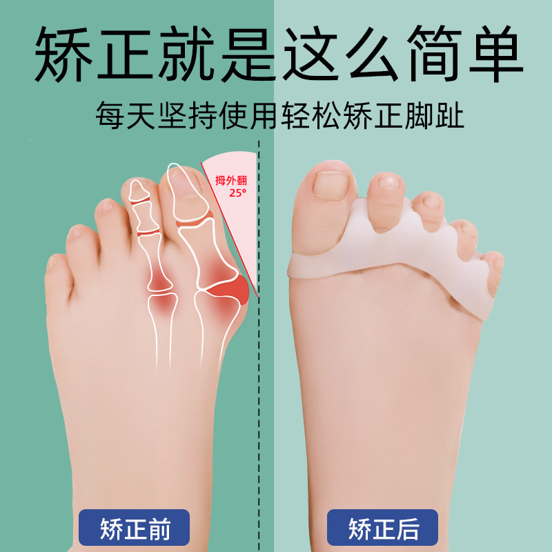 爪形脚趾矫正推荐品牌 新人首单立减十元 21年6月 淘宝海外 爪形脚趾矫正推荐品牌 新人首单立减十元 21年6月 淘宝海外