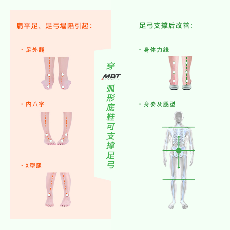 MBT弧形底女厚底休闲凉鞋足弓支撑  足跟痛 增高提臀 羊皮KIBURI