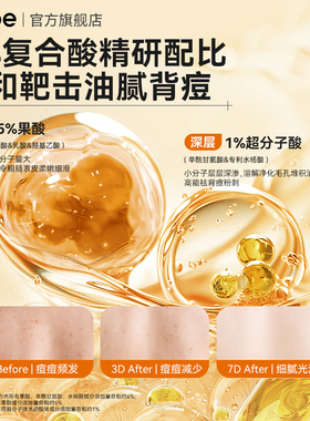nebe果酸祛痘保湿舒缓沐浴露留香