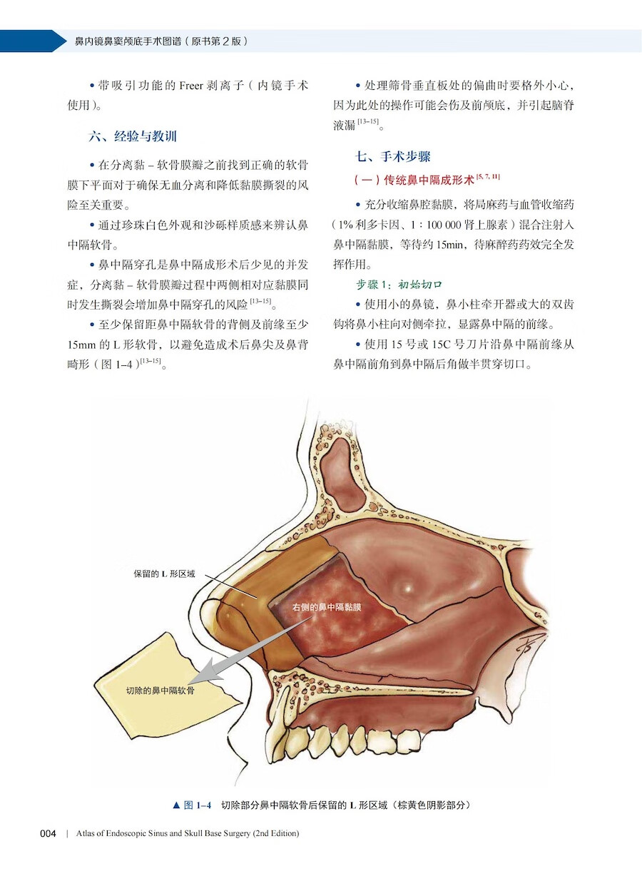 鼻内镜鼻窦颅底手术图谱（原书第2版）国际经典神经外科学译著[美]亚历山大·G.邱中国科学技术出版社-图3