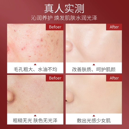 Увлажняющая питательная восстанавливающая маска для лица, сужает поры