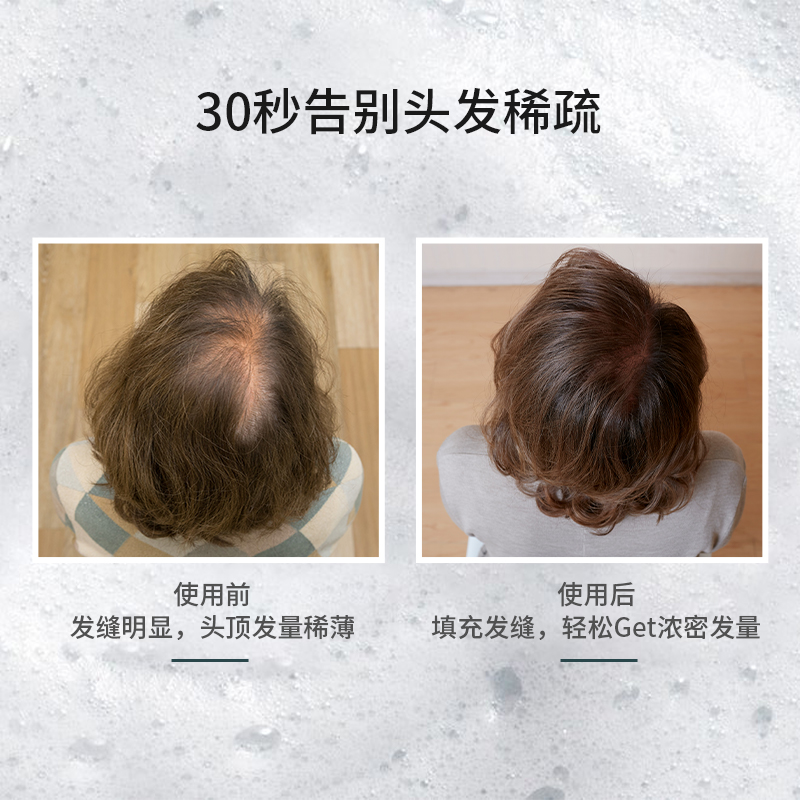 Newmo密发粉+密发喷雾增发补发际线粉填充神器秃顶发缝稀疏遮盖