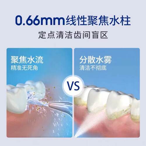 美国洁碧冲牙器喷头WP560/660/GT2/GT3/GS5/GS8/GS9/GT17喷嘴配件 - 图0