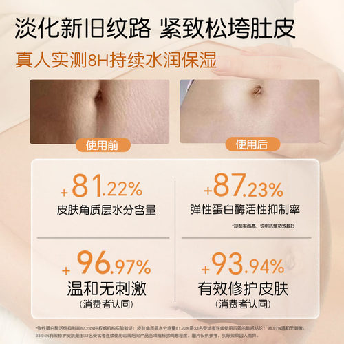 纽乐葆nlb妊娠油纹修护按摩油妈妈保湿橄榄油身体护肤品旗舰店堡 - 图1