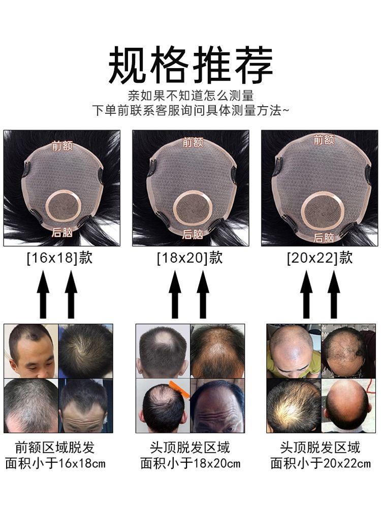 假发男短发真发帅气毛寸补发片男士秃顶头顶补发轻薄自然透气清爽-图2