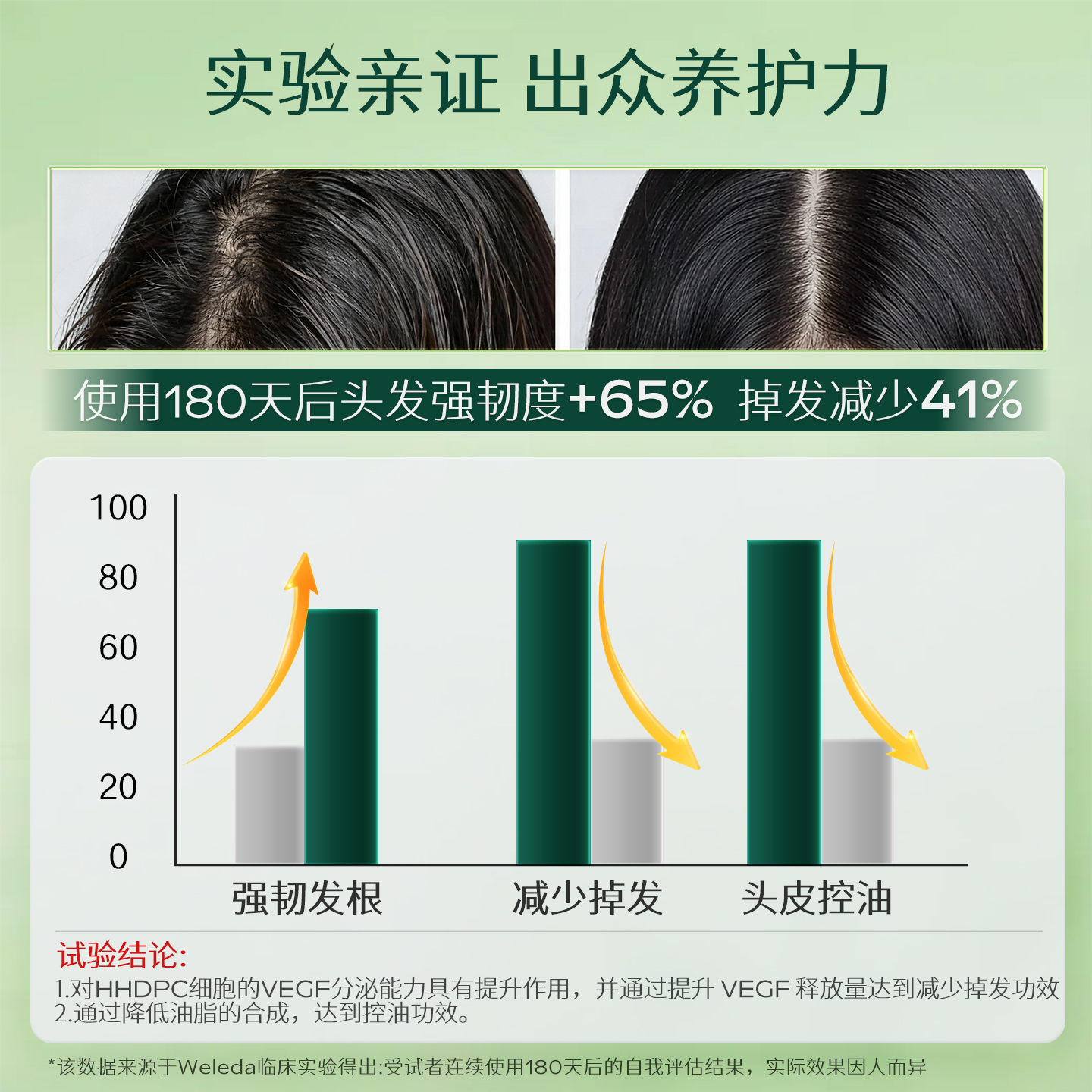 WELEDA维蕾德迷迭香头皮精华护理液清爽控油蓬松舒缓止痒强韧发根