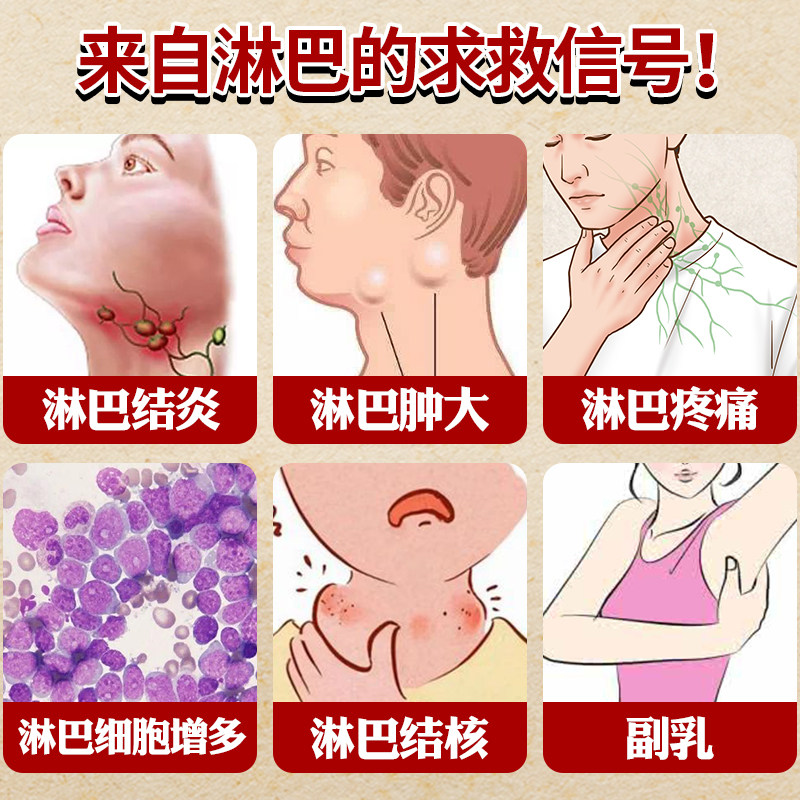 淋巴排毒脖子疏通神器颈部消炎贴膏 晟耀护具（器械）