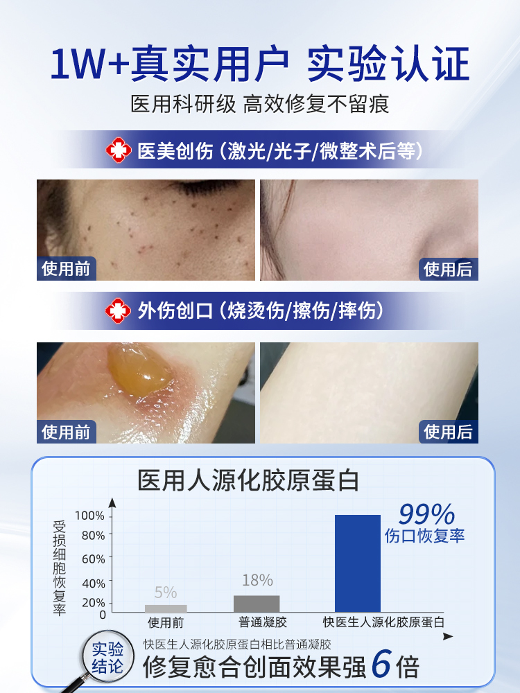 医用三型人源化胶原蛋白修复护理膜非重组人体表皮成长因子凝胶-图2