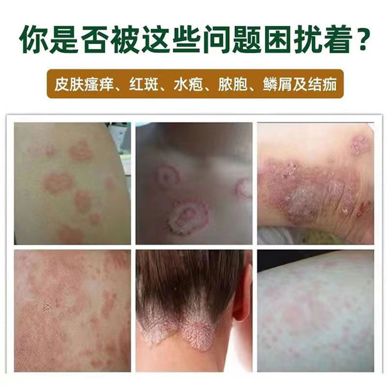  美力斯保健理疗