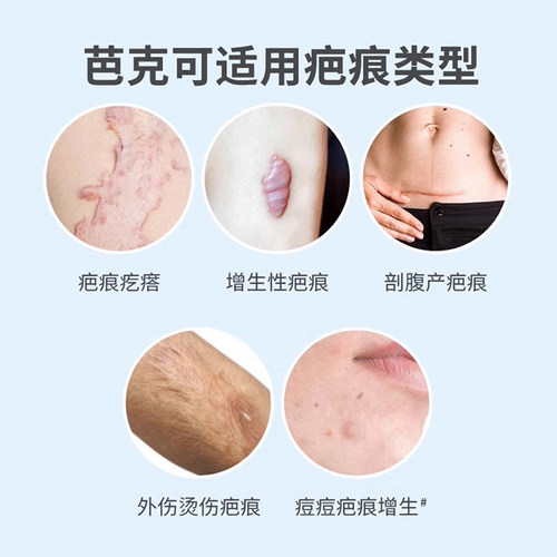 美国KeloCote芭克疤克祛疤膏15g正品淡疤去疤痕修复护增生硅凝胶 - 图0