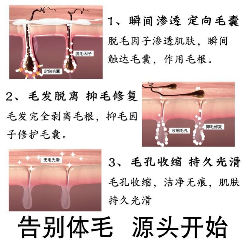 (毛毛自动脱落)抑制生长不再脱毛膏 Fcren脱毛膏