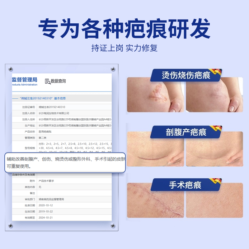 疤痕贴剖腹产遮祛疤贴隐形增生去除疙瘩纯肤贴医用硅凝胶酮修复贴 - 图2