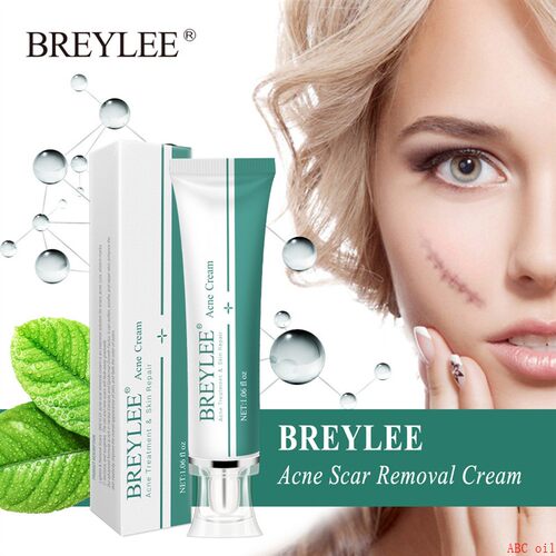 Scar Removal Cream Stretch Marks Removal Acne Skin祛疤膏修护 - 图0