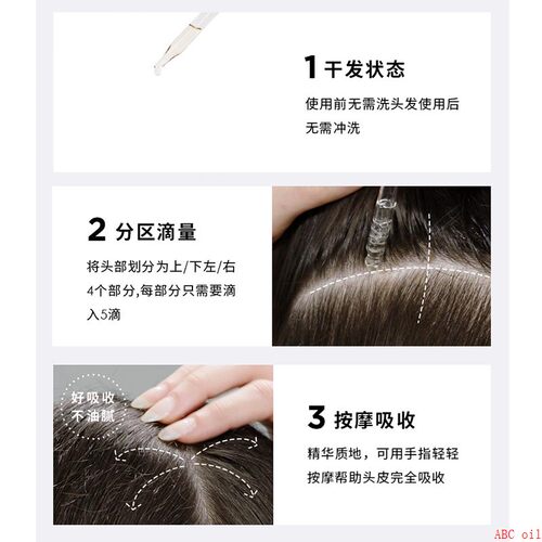 minoxidil hair growth serum anti loss slip scalp care头发液 - 图1