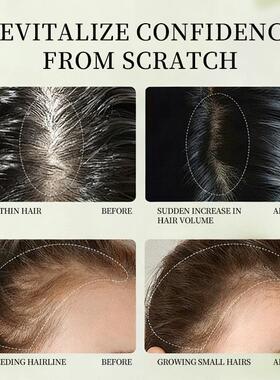 Anti Hair Loss Scalp Spray头皮护理喷雾支持小批量定制OEM