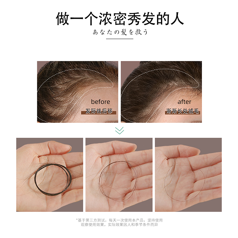 日本进口NOVELLA那绯澜草本植物生姜洗发水防脱发中草药洗发露 - 图3