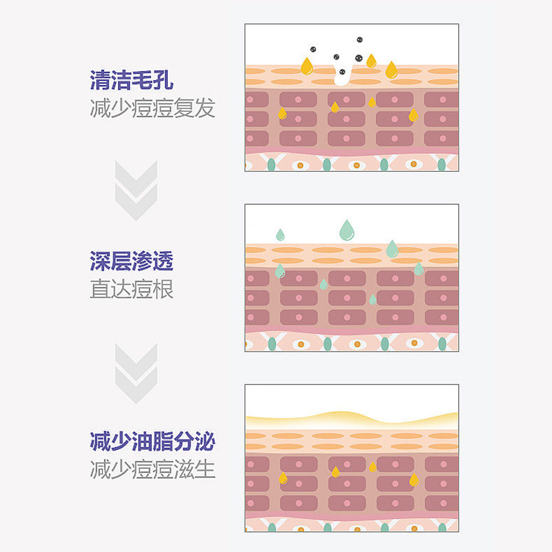 狮王祛痘洗面奶-图2