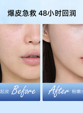 进口凡士林晶冻滋润保湿修护用