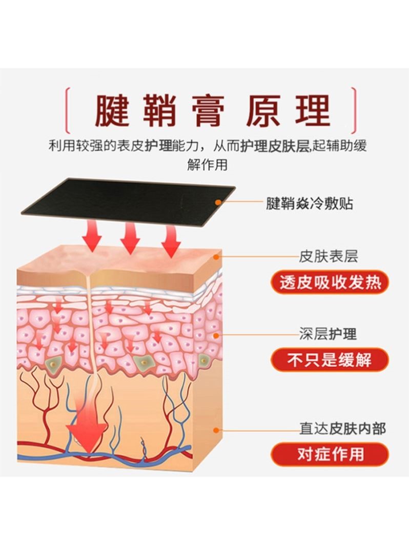 治腱鞘舒筋膏专攻手腕鼔包囔肿防护手部手腕关节疼痛肿大专用药膏 - 图0