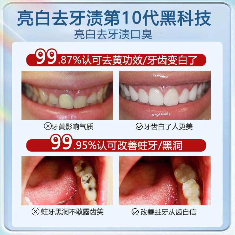 春雨树益生菌亮白牙膏焕亮去黄牙渍清新口气腔官方旗舰店正品-图1