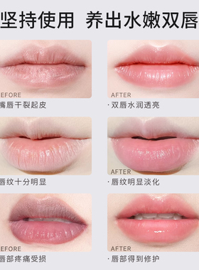 【累计爆卖6257+】百蕾适润唇膏