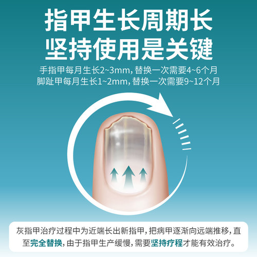 轻大夫盐酸阿莫罗芬搽剂3ml治疗灰指甲专用药正品甲癣真菌环吡酮 - 图3