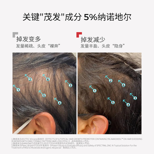 DS实验室纳诺地尔紫标防脱育发精华液增密厚发头皮护理非米诺地尔 - 图0