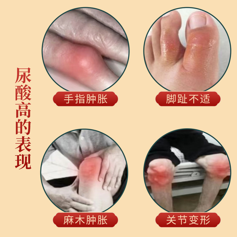 日本痛风冷敷疑胶贴降尿酸高溶石去结晶凝胶酸友消止痛膏专用风湿 - 图0