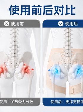 髋关节保护带护髋带护胯股骨头固定支撑髋骨加压保护带大腿髋关节