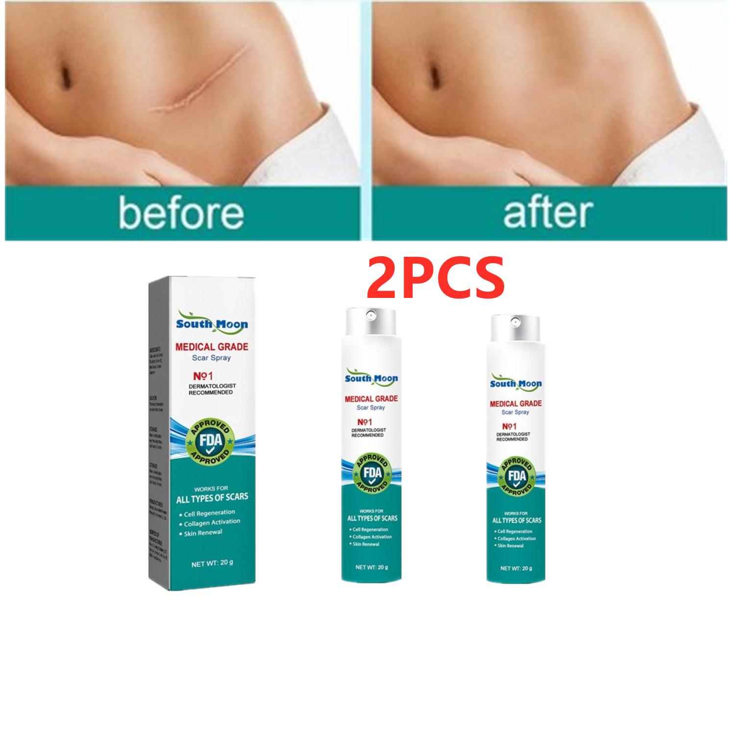 2X Scar Removal Spray Fade Scar Cream Gel /Repair Cream Remo - 图3