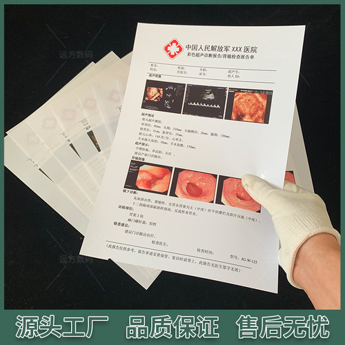A4彩超胶片纸白色激光胶片双面打印胶片纸B超胶片纸白色激光胶片-图2