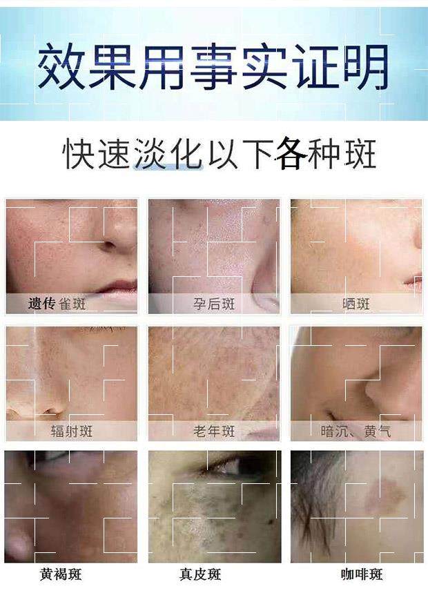 广药敬修堂佰花方补水晒斑祛斑霜 雪蜜雪乳液/面霜