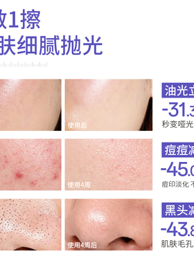 【全网热销】brlab水杨酸棉片