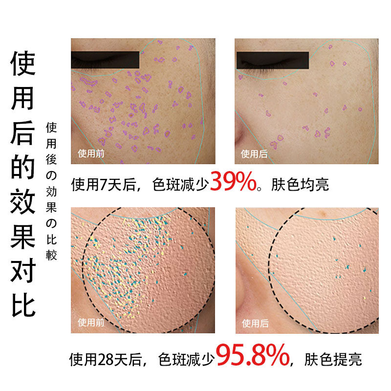 当晚见效祛斑药霜祛黄褐斑黑色素 FTFR乳液/面霜