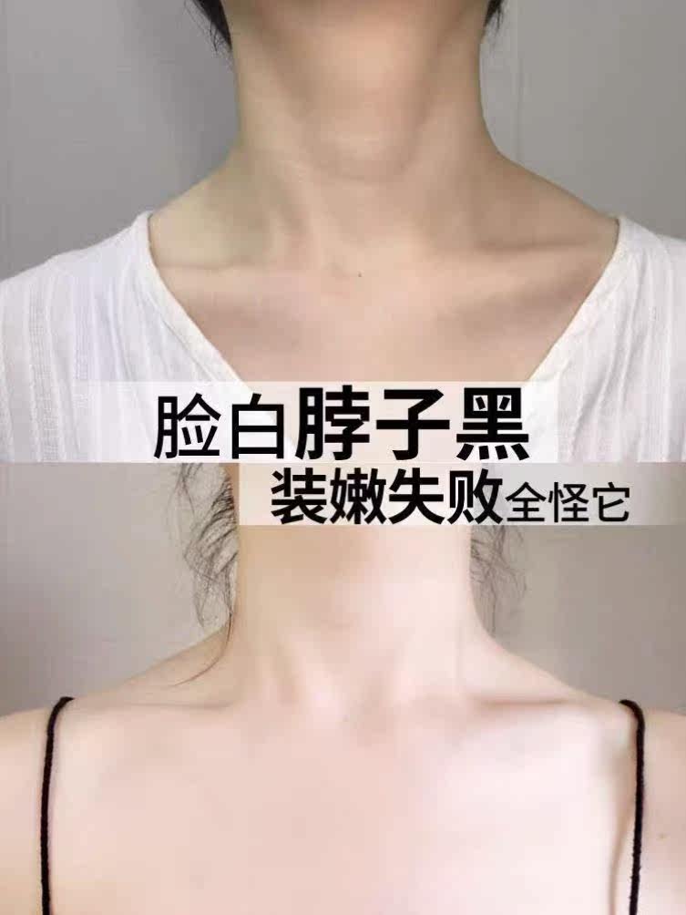脖子美白啫喱全身去除黑色素颈霜 FTFR颈霜