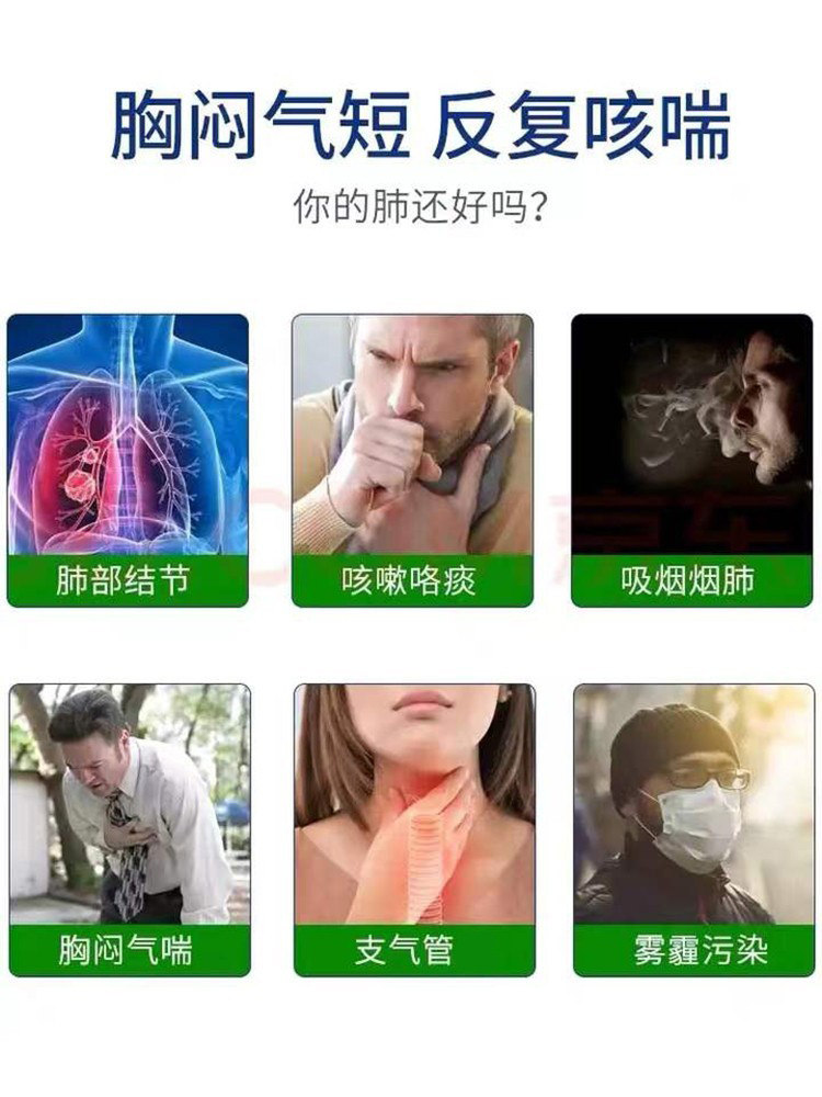 咳嗽贴止咳化痰润肺消炎治胸闷气短 利军医疗器械膏药贴（器械）