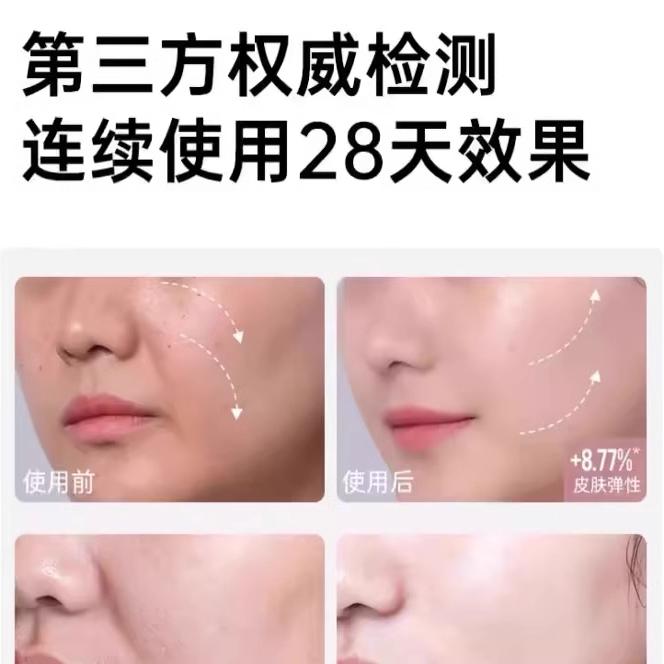 【韩国黑科技面料】石墨烯瘦脸绷带v脸绷带提拉紧致提双下巴塑形 - 图1