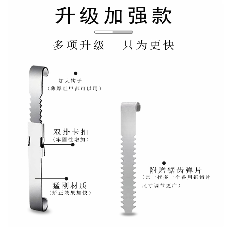 甲沟矫正器嵌甲矫正器脚趾甲卷指甲纠正神器正甲扣拉拉炎正甲贴片 - 图1