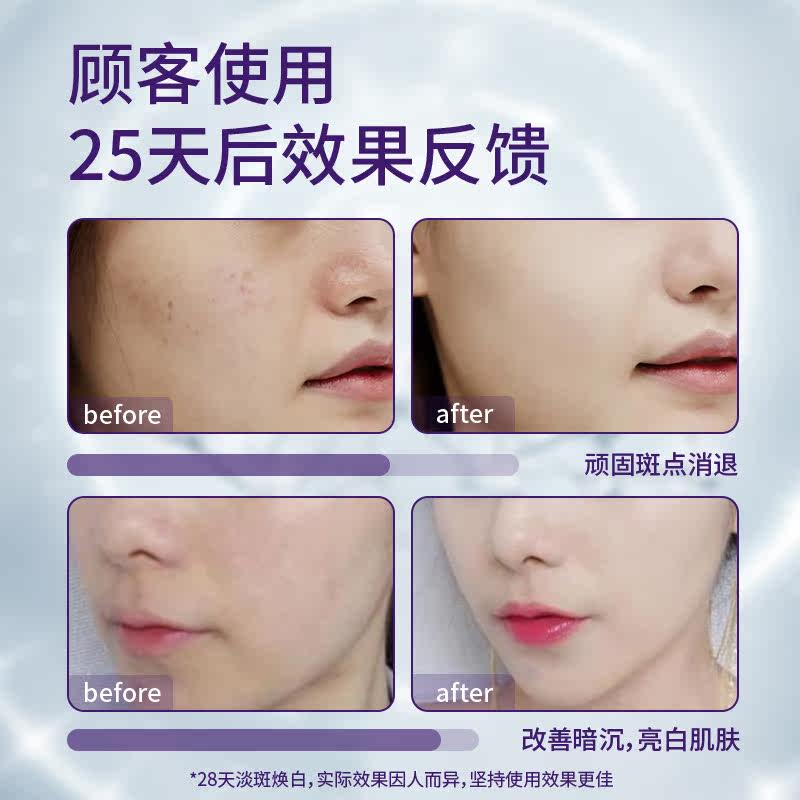 韩国进口美白淡化色斑官方祛斑霜 poobae海外乳液/面霜